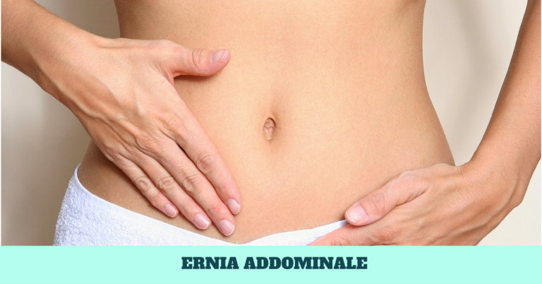 Ernia Addominale