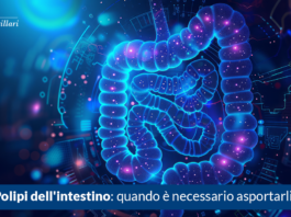 Polipi dell'intestino, quando è necessario asportarli