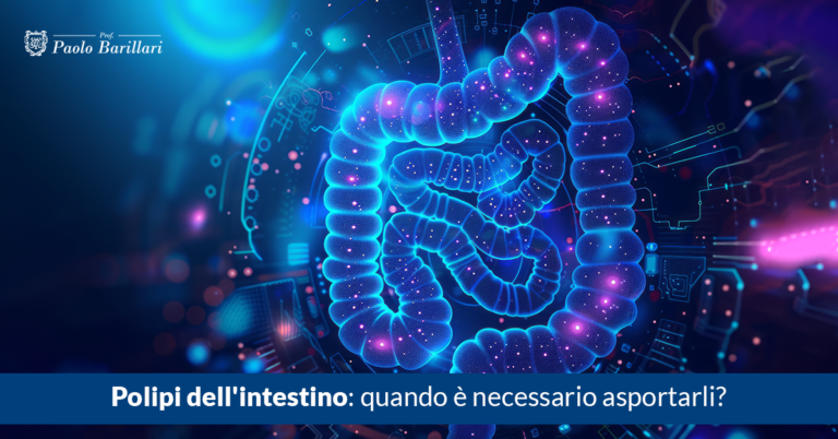 Polipi dell'intestino, quando è necessario asportarli